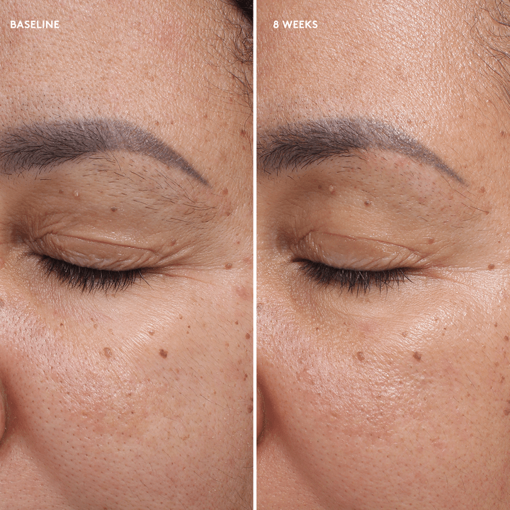 Total Eye Firm & Repair Cream - BASELINE - 8 weeks - model Img - Colorescience UK 