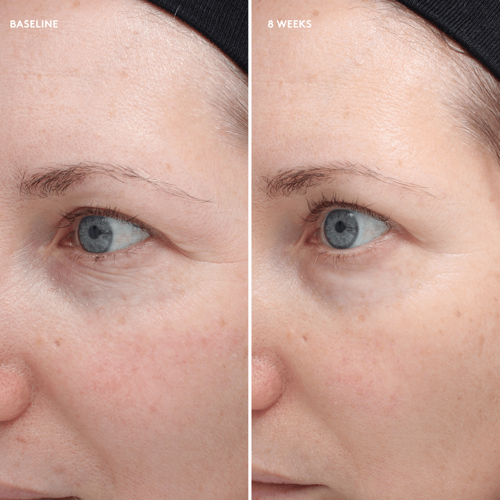 Total Eye Firm & Repair Cream - BASELINE - 8 weeks - Model Img - Colorescience UK 
