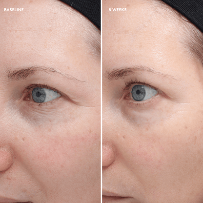 Total Eye Firm & Repair Cream - BASELINE - 8 weeks - Model Img - Colorescience UK 